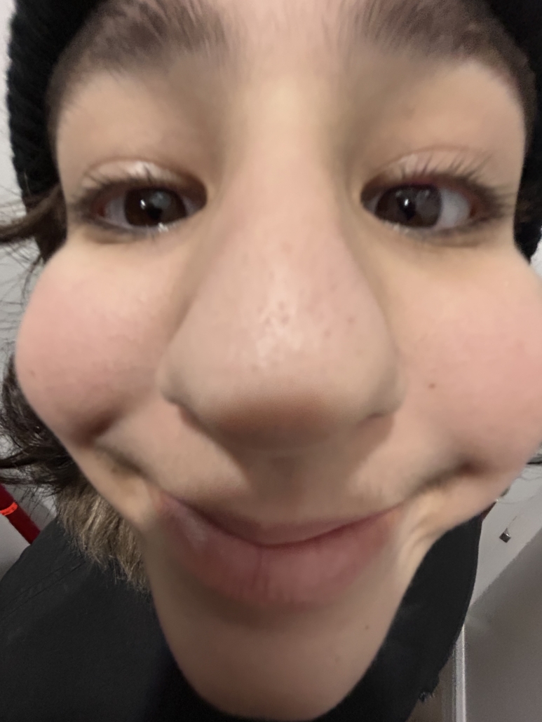 A person’s face is seen in close-up, with an exaggerated nose and smile, wearing a black hat, indoors. No landmarks visible.